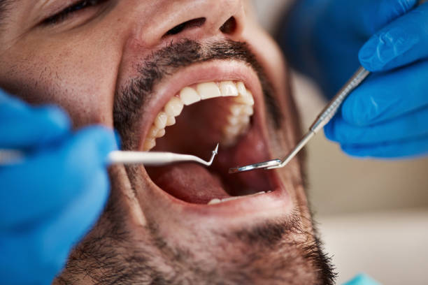 Best Emergency Denture Repair in Redwood Valley, CA